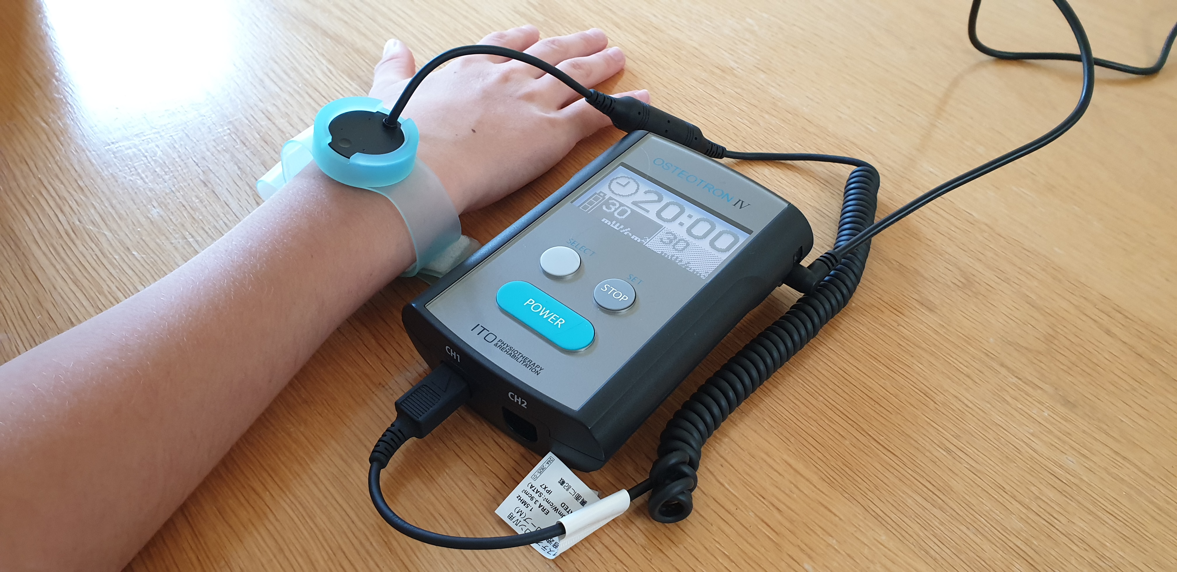 Low intensity pulsed ultrasound machine strapped to a patients wrist